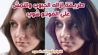 طريقة ازاله الحبوب والنمش من الوجه علي الفوتو شوب