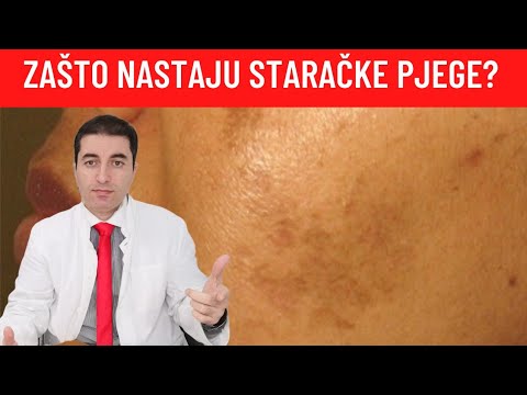 Zašto nastaju STARAČKE