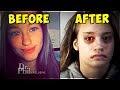 Dr. Phil Can't Believe Criminal Teen... (CRAZY)