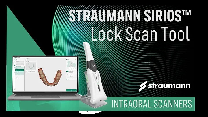 SIRIOS Lock Scan Tool