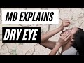 What you need to know about DRY EYE (and my *favorite* dry eye drop!)