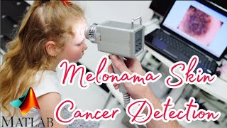 Melanoma Skin Cancer Detection Using BPNN with ABCD Features | Latest Matlab - Final Year Projects