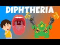 Understanding Diphtheria