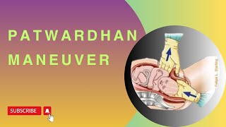 Patwardhan Maneuver: Technique for Impacted Shoulder in Cesarean Section
