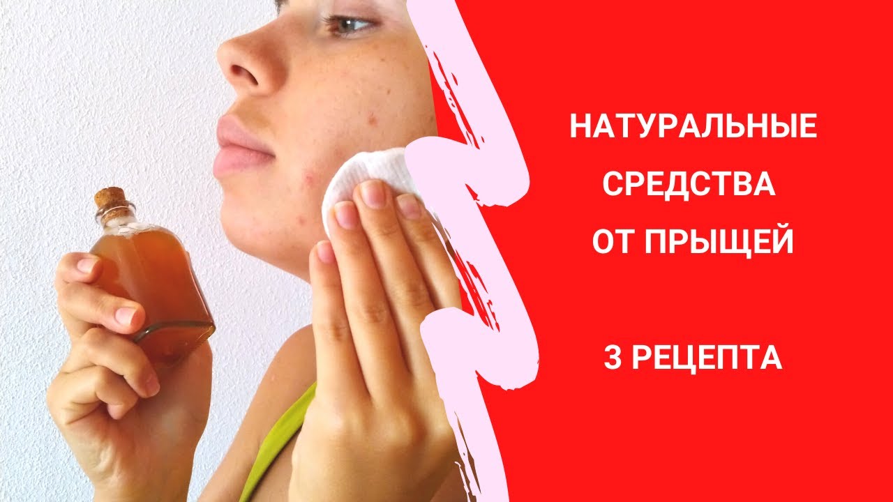 Натуральные средства от прыщей. 3 рецепта для ухода за кожей.