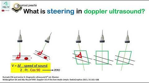 What is "steering" in Doppler ultrasound?