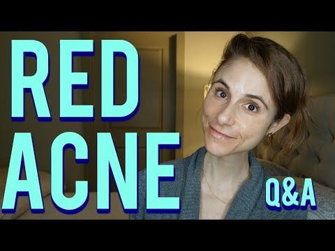 Red acne marks on the face: Q&A with a dermatologist|Dr Dray