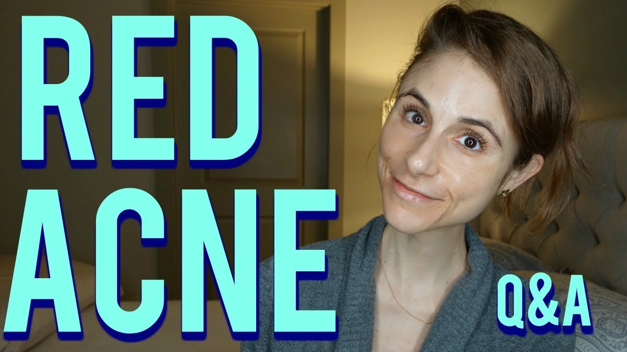 red acne scars fade Red acne marks on the face: Q&A with a dermatologist|Dr Dray