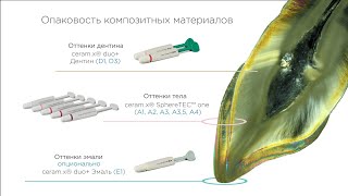 видео: Комбинация композитов ceram.x ceram x SphereTEC one и ceram.x duo+ при реставрации фронтальных зубов картинка: Комбинация композитов ceram.x ceram x SphereTEC one и ceram.x duo+ при реставрации фронтальных зубов