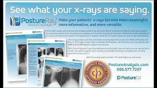 PostureRay Introduction