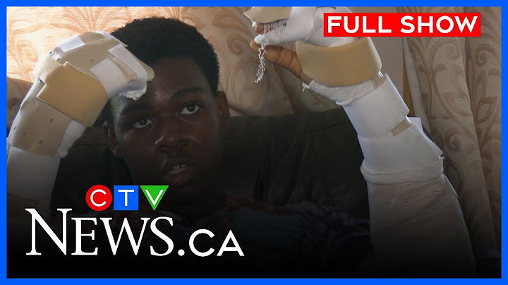 Sword attack victim speaks out in Brandon | CTV Morning Live Winnipeg for June 19, 2025
