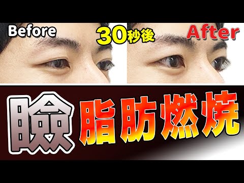 [Eyelid Massage] How to remove swollen and puffy eyelid fat in 30 seconds!