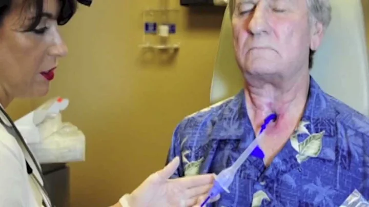 Placement of a Provox Vega TEP (voice prosthesis) with the SmartInserter