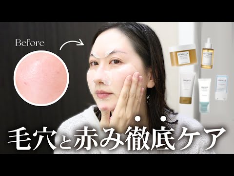 3日で肌人生変える🔥敏感肌の｢毛穴と赤み徹底ケア｣｜IVEのレイちゃんに学ぶモチ肌スキンケア
