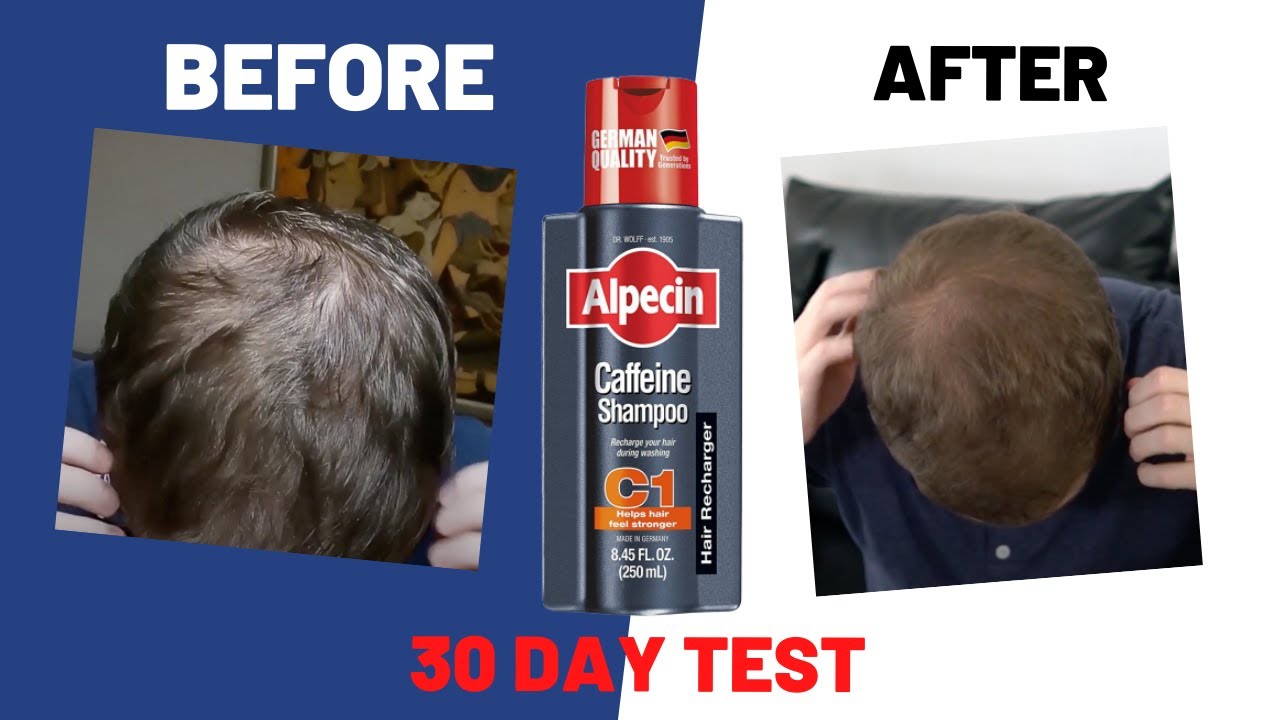 I used Caffeine Shampoo" for 30 days. Here's happened... - YouTube