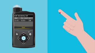 Insulin Pump: 4. Bolus Wizard (MM770G)