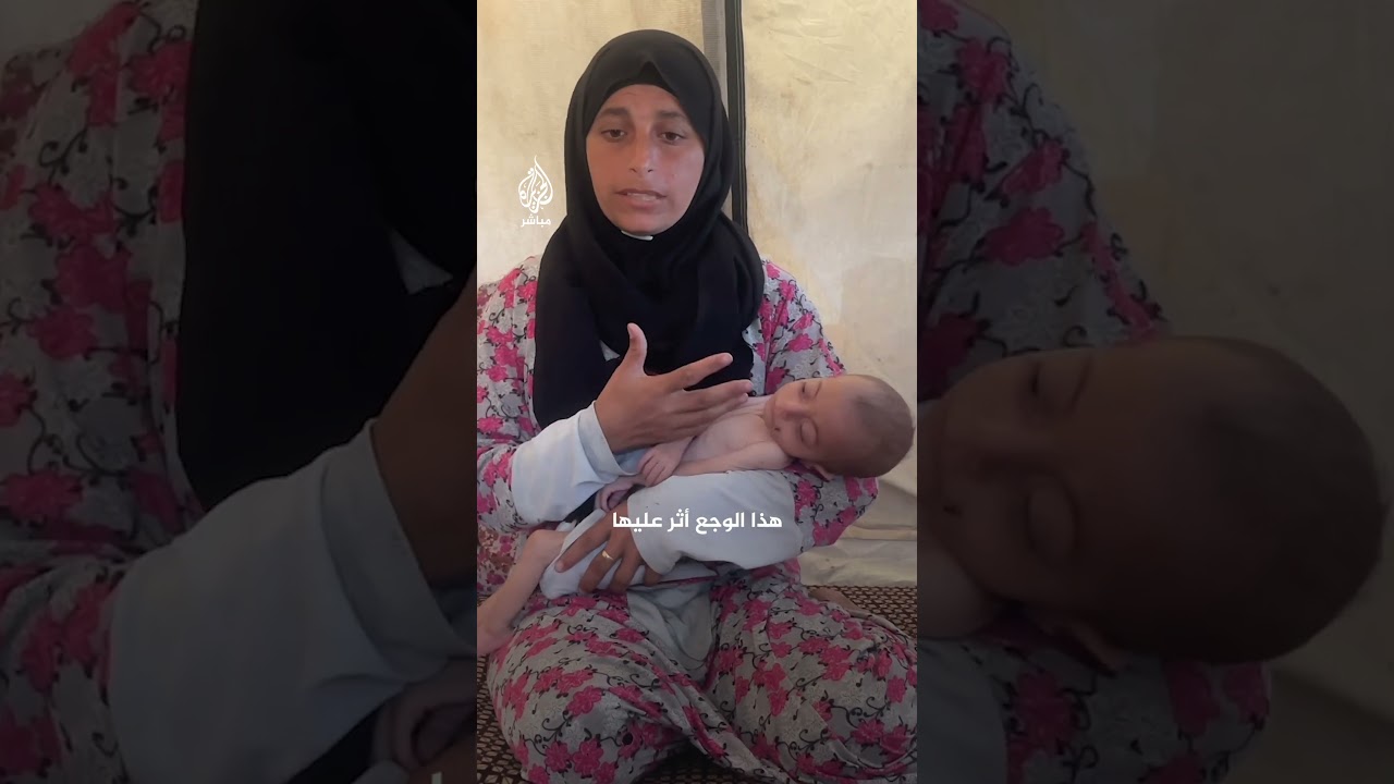 فرحانة الأشقر.. رضيعة غزية ولدت بسرطان الدماغ ولا تجد العلاج