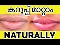 കറുത്തിരുണ്ട ചുണ്ടുകള്‍ ചുവക്കാന്‍ Men and Women ( 2019 ) | pink lips no cream no makeup products