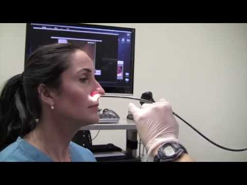 Video: Ösophagoskopie: Definition, Vs. Endoskopie, Verwendung Und Mehr
