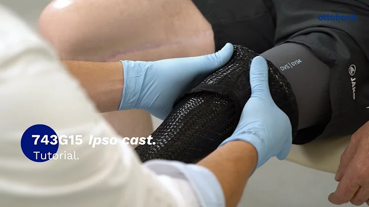 743G15 Ipso Cast: Plaster casting a below-knee res...