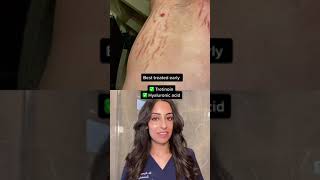 How to TREAT stretch marks | Dr Adel #shorts