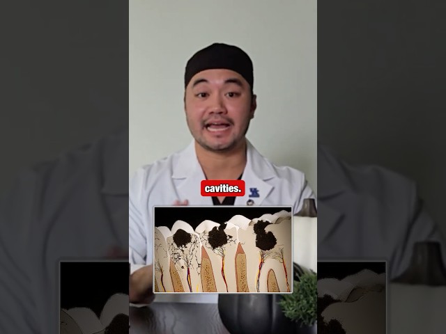 The HIDDEN Cause Of Your Tooth DECAY 👉 #smile #dentistry #dentist #dentalclinic