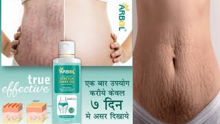 Which is the best stretch marks oil Best Stretch Marks Oil Organic