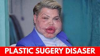 20 Famous Celebrities Unrecognizable After Plastic Surgery Gone Wrong | Then and Now 2026