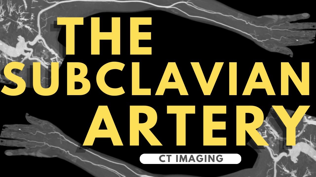 Анатомия подключичной артерии | Артериальное кровоснабжение верхней конечности | Подготовка к рен...