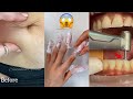 Most Extreme Beauty Treatments 2021 Best Smart and Helpful Beauty Hacks | Virtual Beauty