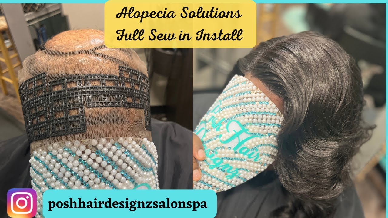 Поддержка фонда для предотвращения дальнейшего выпадения волос по линии роста волос/по краям | Ре...