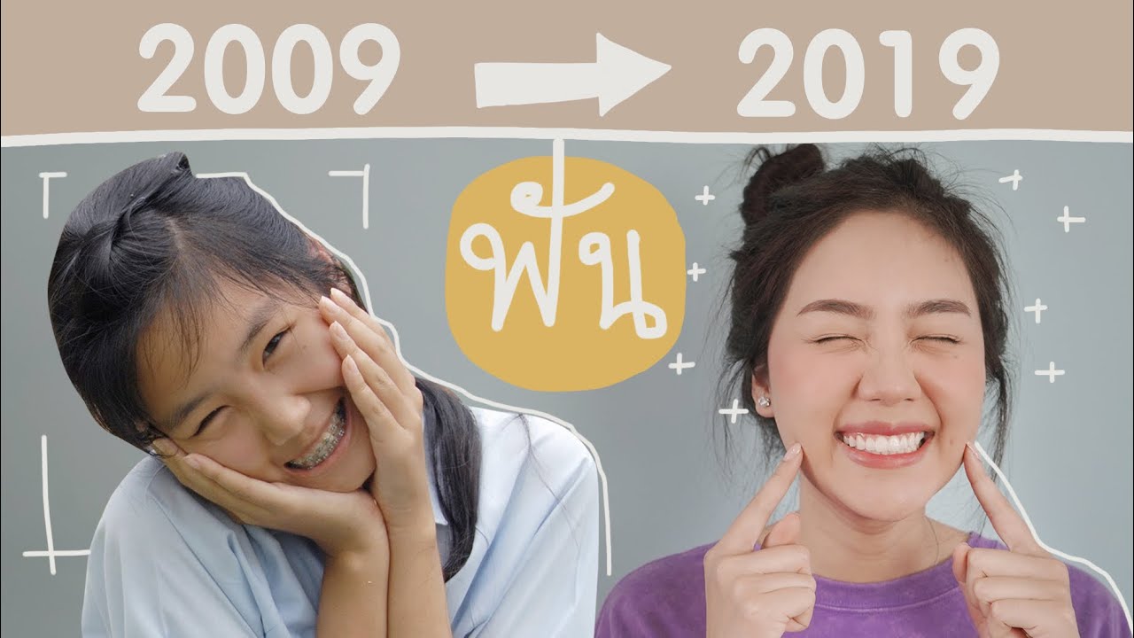 รีวิวดัดฟัน ทำฟันขาว ตัดเหงือก ตั้งแต่ 2009-2019 | Archita Lifestyle