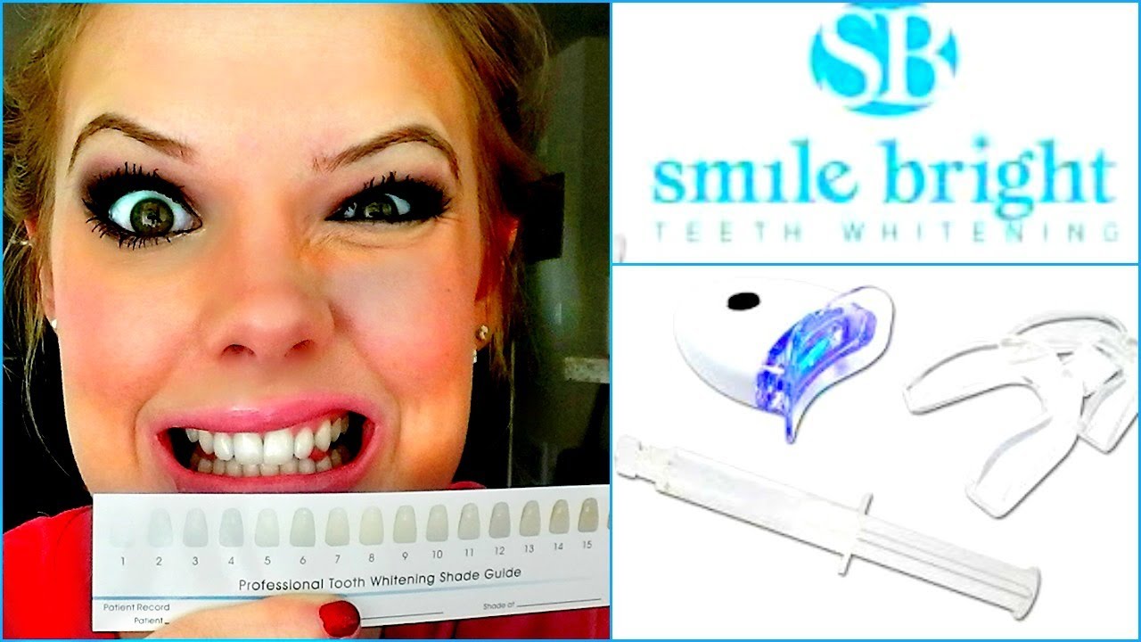 Teeth Whitening Vlog Smile Bright Whitening System Youtube