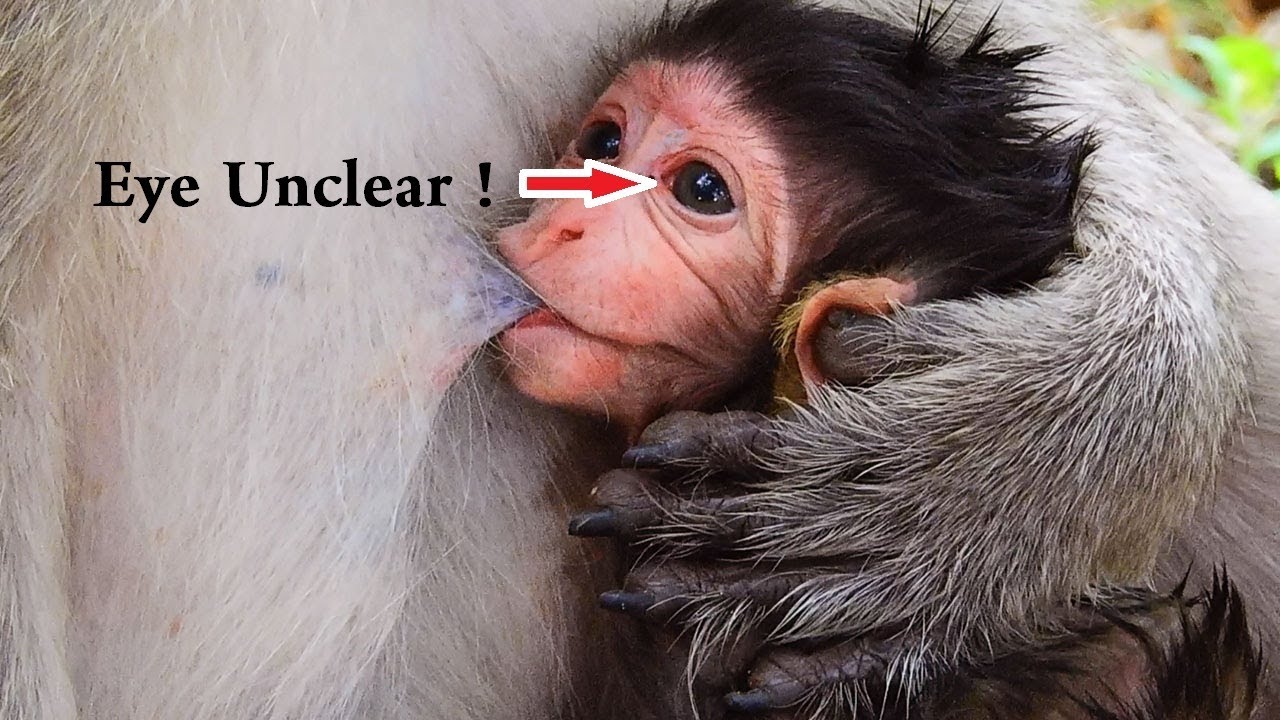 problem synonym Eyes Unclear, Problem Insect Into Eyes Newborn baby Lizza/ Look Not Clear