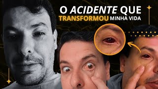 Um segundo de desatenção: o acidente com laser que transformou minha vida