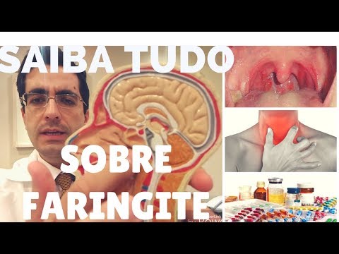 FARINGITE:  O QUE É , QUAIS SÃO AS CAUSAS E COMO PREVENIR?/ Dr Paulo Mendes Jr- Otorrino em Curitiba