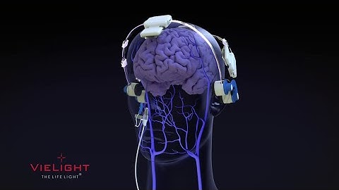 Transcranial and Intranasal Photobiomodulation