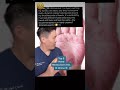 Shorts Recommended Products For Dry Cracked Hands Shorts Recommended Products For Dry Cracked Hands