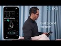 AI-Enabled Cardiac Ultrasound for Clinicians | Exo Iris™