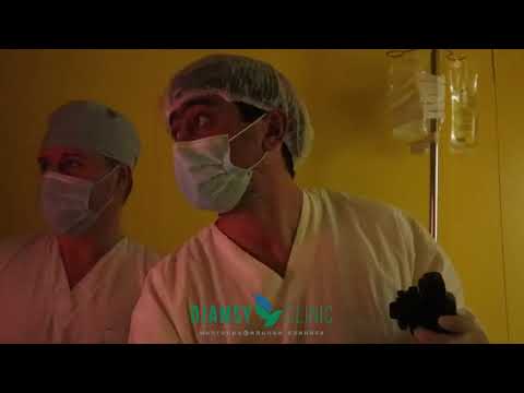 Полипэктомия