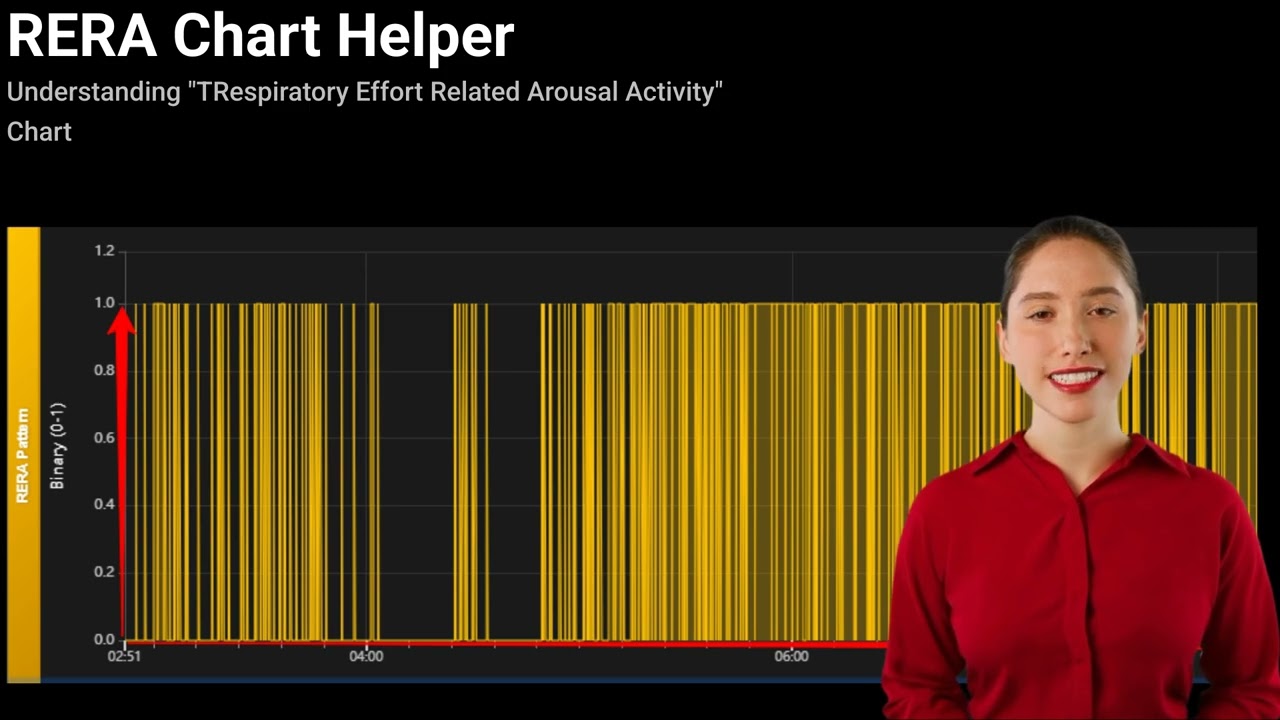 RERA Chart Helper