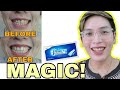PUMUTI AGAD! 3D WHITE TEETH WHITENING STRIPS | PERMANENT BA? FINAL THOUGHTS | SIR LAWRENCE