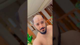 Yeh Kaise Hua ? baldness Ko Turant Hi Tata Bye Bye Bol Diya 😨