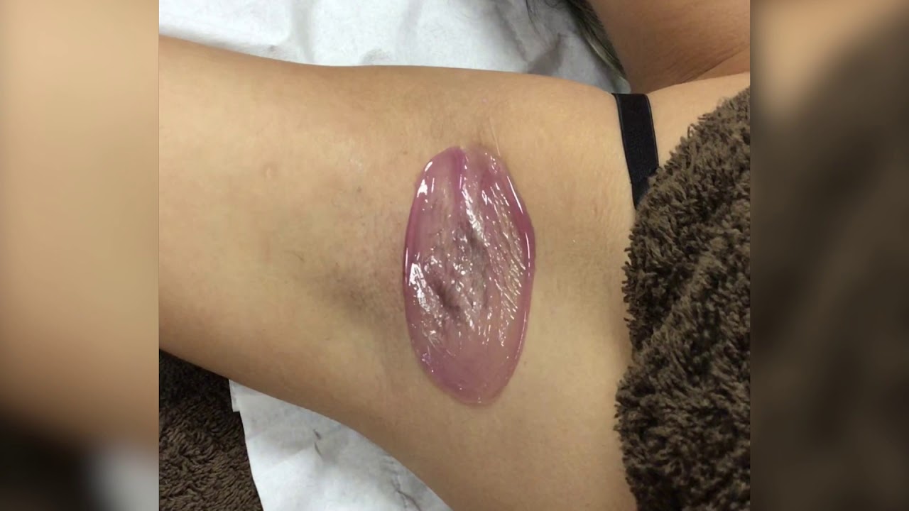 Underarm wax using Outback Opal Peelable Hot wax