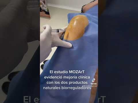 Tratamiento biorregulador para el manejo de la osteoartritis