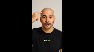 What is Scalp Micro Pigmentation #shorts