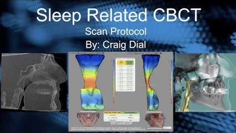 Sleep Scan Protocols
