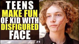 Teens Make Fun of Kid with DISFIGURED FACE!!!!
