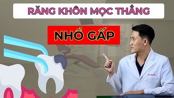 NHỔ Răng Khôn MỌC THẲNG Nếu Có Những Triệu Chứng Sau.