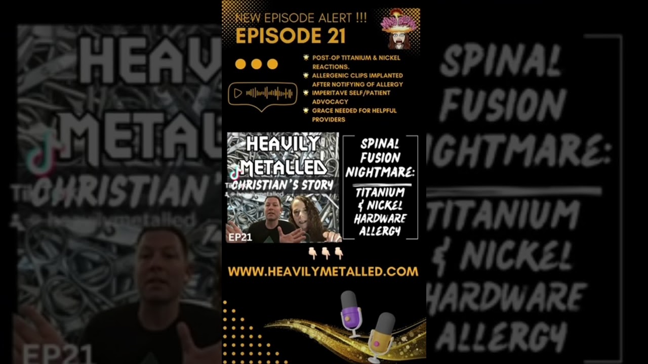 Titanium & Nickel Surgical Hardware Allergy + Surgical Clips #surgery #nickel #titanium #allergy